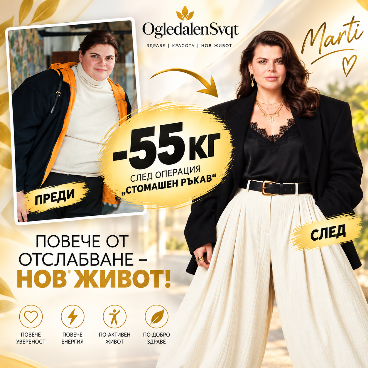 Марти след операция „стомашен ръкав“ – впечатляваща промяна със загуба на 55 кг, OgledalenSvqt.